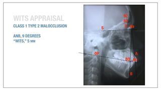 Orthodontics Case Analysis