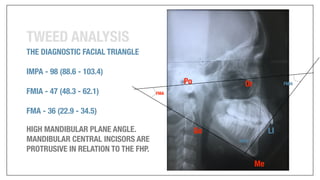 Orthodontics Case Analysis