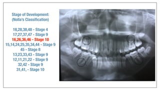 Orthodontics Case Analysis