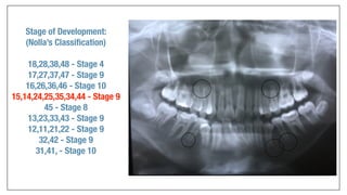 Orthodontics Case Analysis
