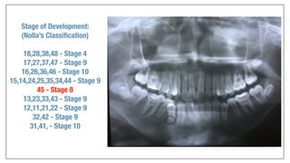 Orthodontics Case Analysis
