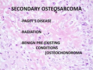 SECONDARY OSTEOSARCOMA
-PAGET’S DISEASE
-RADIATION
-BENIGN PRE-EXISTING
CONDITIONS
[OSTEOCHONDROMA

 