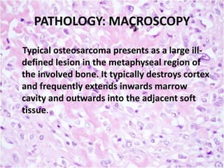 PATHOLOGY: MACROSCOPY
Typical osteosarcoma presents as a large illdefined lesion in the metaphyseal region of
the involved bone. It typically destroys cortex
and frequently extends inwards marrow
cavity and outwards into the adjacent soft
tissue.

 