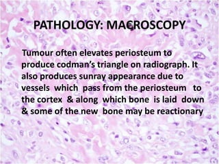 PATHOLOGY: MACROSCOPY
Tumour often elevates periosteum to
produce codman’s triangle on radiograph. It
also produces sunray appearance due to
vessels which pass from the periosteum to
the cortex & along which bone is laid down
& some of the new bone may be reactionary

 