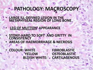 PATHOLOGY: MACROSCOPY
• LARGE ILL-DEFINED LESION IN THE
METAPHYSEAL REGION OF LONG BONE
• LEG OF MUTTON’ APPEARANCE
• STONY-HARD TO SOFT AND GRITTY IN
CONSISTENCY
• AREAS OF HAEMORRHAGE & NECROSIS
• COLOUR: WHITE
:
YELLOW
:
BLUISH WHITE:

FIBROBLASTIC
OSTEOBLASTIC
CARTILAGENOUS

 