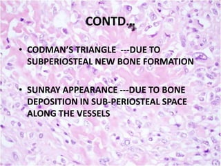 CONTD…
• CODMAN’S TRIANGLE ---DUE TO
SUBPERIOSTEAL NEW BONE FORMATION
• SUNRAY APPEARANCE ---DUE TO BONE
DEPOSITION IN SUB-PERIOSTEAL SPACE
ALONG THE VESSELS

 