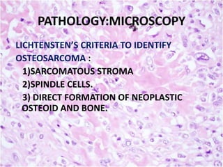 PATHOLOGY:MICROSCOPY
LICHTENSTEN’S CRITERIA TO IDENTIFY
OSTEOSARCOMA :
1)SARCOMATOUS STROMA
2)SPINDLE CELLS.
3) DIRECT FORMATION OF NEOPLASTIC
OSTEOID AND BONE.

 