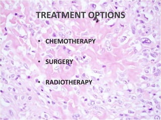 TREATMENT OPTIONS
• CHEMOTHERAPY
• SURGERY
• RADIOTHERAPY

 