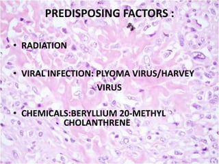 PREDISPOSING FACTORS :
• RADIATION
• VIRAL INFECTION: PLYOMA VIRUS/HARVEY
VIRUS
• CHEMICALS:BERYLLIUM 20-METHYL
CHOLANTHRENE

 