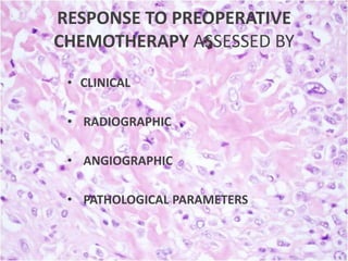 RESPONSE TO PREOPERATIVE
CHEMOTHERAPY ASSESSED BY
• CLINICAL
• RADIOGRAPHIC
• ANGIOGRAPHIC
• PATHOLOGICAL PARAMETERS

 