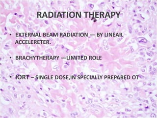 RADIATION THERAPY
• EXTERNAL BEAM RADIATION — BY LINEAR
ACCELERETER.
• BRACHYTHERAPY —LIMITED ROLE

• IORT – SINGLE DOSE,IN SPECIALLY PREPARED OT

 
