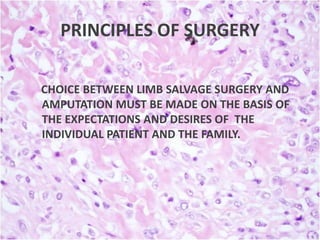 PRINCIPLES OF SURGERY
CHOICE BETWEEN LIMB SALVAGE SURGERY AND
AMPUTATION MUST BE MADE ON THE BASIS OF
THE EXPECTATIONS AND DESIRES OF THE
INDIVIDUAL PATIENT AND THE FAMILY.

 