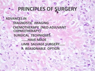 PRINCIPLES OF SURGERY
ADVANCES IN
DIAGNOSTIC IMAGING
CHEMOTHERAPY (NEO-ADJUVANT
CHEMOTHERAPY)
SURGICAL TECHNIQUES
…….HAVE MADE
LIMB SALVAGE SURGERY……
A REASONABLE OPTION

 