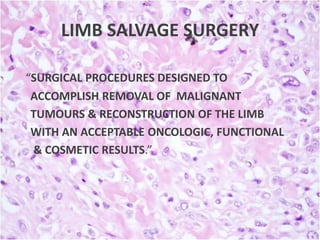 LIMB SALVAGE SURGERY
“SURGICAL PROCEDURES DESIGNED TO
ACCOMPLISH REMOVAL OF MALIGNANT
TUMOURS & RECONSTRUCTION OF THE LIMB
WITH AN ACCEPTABLE ONCOLOGIC, FUNCTIONAL
& COSMETIC RESULTS.”

 