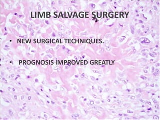 LIMB SALVAGE SURGERY
• NEW SURGICAL TECHNIQUES.
• PROGNOSIS IMPROVED GREATLY.

 