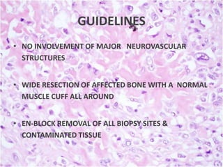 GUIDELINES
• NO INVOLVEMENT OF MAJOR NEUROVASCULAR
STRUCTURES
• WIDE RESECTION OF AFFECTED BONE WITH A NORMAL
MUSCLE CUFF ALL AROUND
• EN-BLOCK REMOVAL OF ALL BIOPSY SITES &
CONTAMINATED TISSUE

 