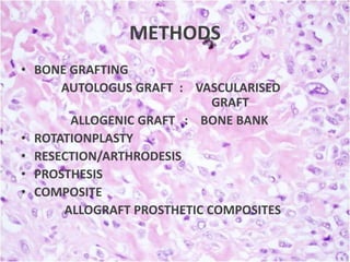 METHODS
• BONE GRAFTING
AUTOLOGUS GRAFT : VASCULARISED
GRAFT
ALLOGENIC GRAFT : BONE BANK
• ROTATIONPLASTY
• RESECTION/ARTHRODESIS
• PROSTHESIS
• COMPOSITE
ALLOGRAFT PROSTHETIC COMPOSITES

 
