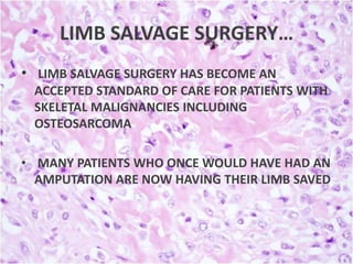 LIMB SALVAGE SURGERY…
• LIMB SALVAGE SURGERY HAS BECOME AN
ACCEPTED STANDARD OF CARE FOR PATIENTS WITH
SKELETAL MALIGNANCIES INCLUDING
OSTEOSARCOMA
• MANY PATIENTS WHO ONCE WOULD HAVE HAD AN
AMPUTATION ARE NOW HAVING THEIR LIMB SAVED

 