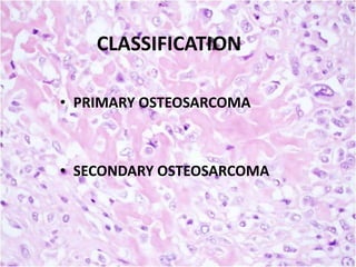 CLASSIFICATION
• PRIMARY OSTEOSARCOMA

• SECONDARY OSTEOSARCOMA

 