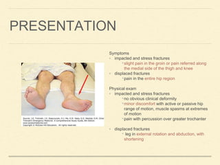 PRESENTATION
Symptoms
◦ impacted and stress fractures
•slight pain in the groin or pain referred along
the medial side of the thigh and knee
◦ displaced fractures
•pain in the entire hip region
Physical exam
◦ impacted and stress fractures
•no obvious clinical deformity
•minor discomfort with active or passive hip
range of motion, muscle spasms at extremes
of motion
•pain with percussion over greater trochanter
◦ displaced fractures
• leg in external rotation and abduction, with
shortening
 