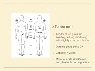 Tender point
Tender at left groin, no
swelling, left leg shortening
with slightly external rotation
Dorsalis pedis pulse 2+
Cap.refill < 2 sec
Motor of ankle dorsiflexion
and plantar flexion = grade V
 