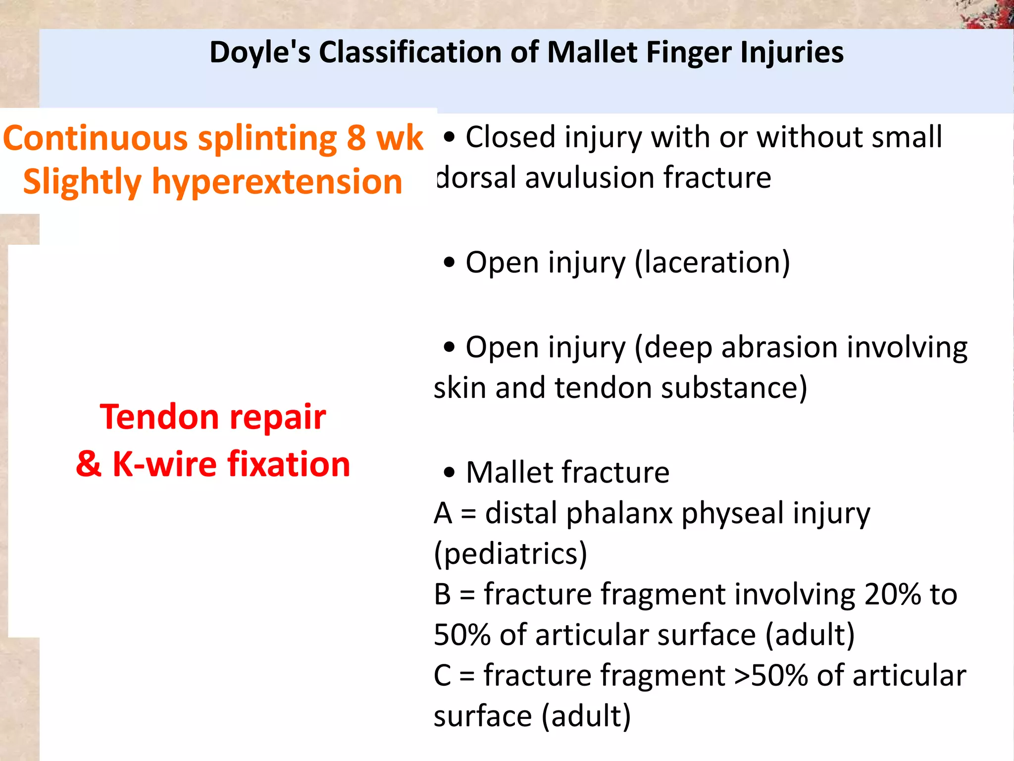 Doyle's Classification of Mallet Finger Injuries
Type I • Closed injury with or without small
dorsal avulusion fracture
Type II • Open injury (laceration)
Type III • Open injury (deep abrasion involving
skin and tendon substance)
Type IV • Mallet fracture
A = distal phalanx physeal injury
(pediatrics)
B = fracture fragment involving 20% to
50% of articular surface (adult)
C = fracture fragment >50% of articular
surface (adult)
Continuous splinting 8 wk
Slightly hyperextension
Tendon repair
& K-wire fixation
 