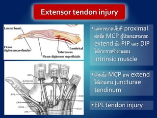 Extensor tendon injury
 