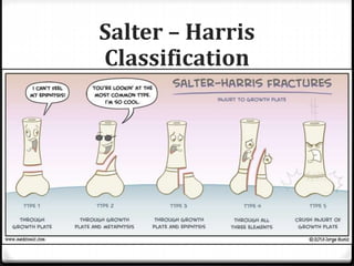 Salter – Harris
Classification
 