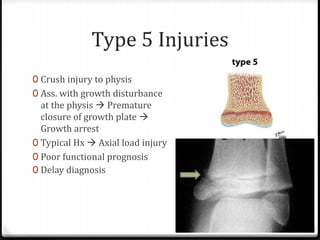 Type 5 Injuries
0 Crush injury to physis
0 Ass. with growth disturbance
at the physis  Premature
closure of growth plate 
Growth arrest
0 Typical Hx  Axial load injury
0 Poor functional prognosis
0 Delay diagnosis
 