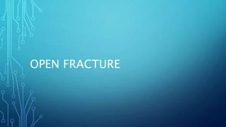 OPEN FRACTURE
 