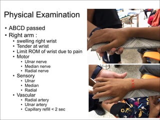 Physical Examination
• ABCD passed
• Right arm :
• swelling right wrist
• Tender at wrist
• Limit ROM of wrist due to pain
• Motor
• Ulnar nerve
• Median nerve
• Radial nerve
• Sensory
• Ulnar
• Median
• Radial
• Vascular
• Radial artery
• Ulnar artery
• Capillary refill < 2 sec
XXX
 