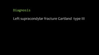 Diagnosis
Left supracondylar fracture Gartland type III
 