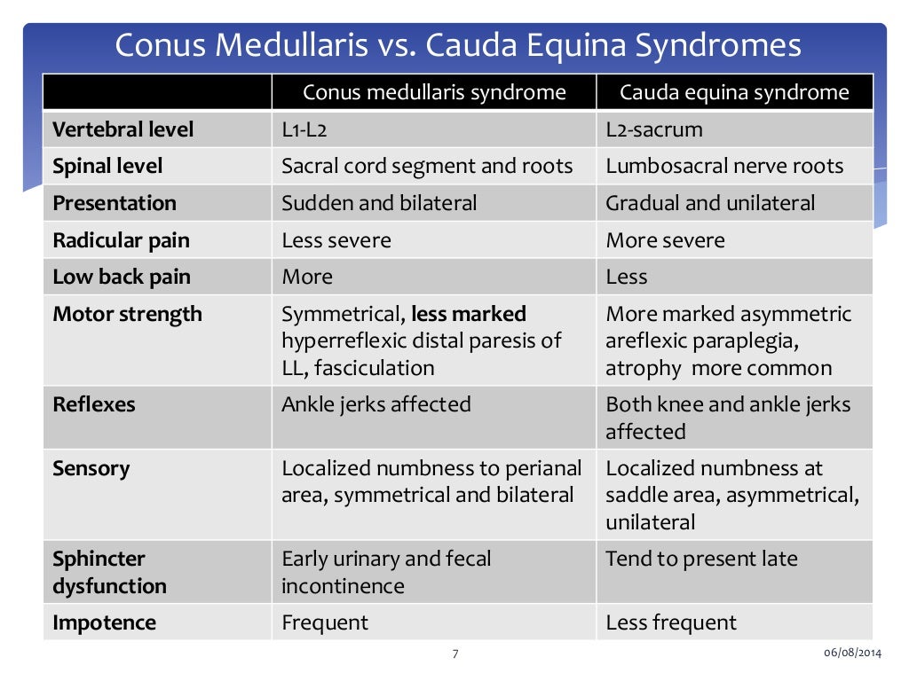 Difference Between Conus Medullaris And Cauda Equina