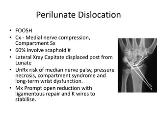 Orthopaedics | PPTX