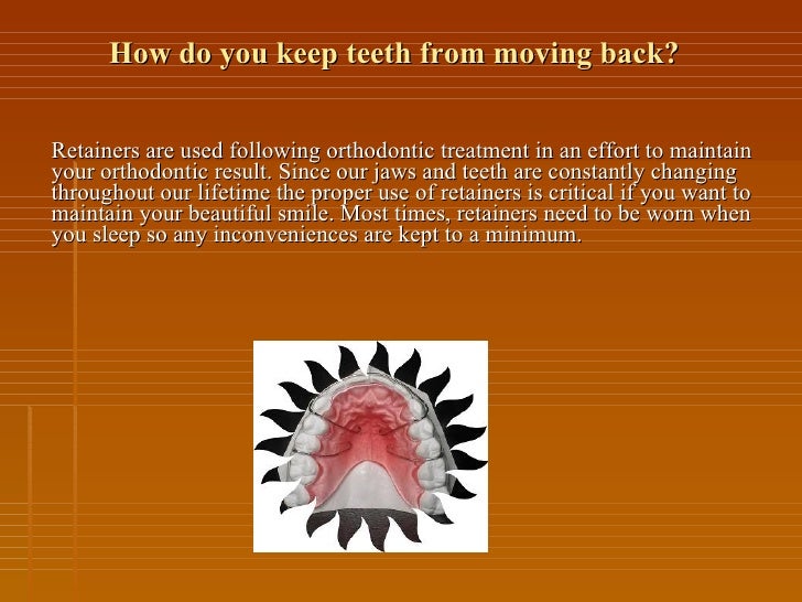 Orthodontic Procedures Presentation