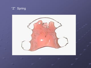 Orthodontic Appliance | PPTX