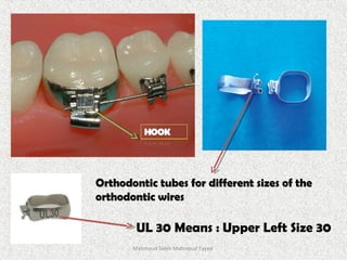 UL 30 Means : Upper Left Size 30
Orthodontic tubes for different sizes of theOrthodontic tubes for different sizes of the
orthodontic wiresorthodontic wires
Mahmoud Saleh Mahmoud Fayed
 