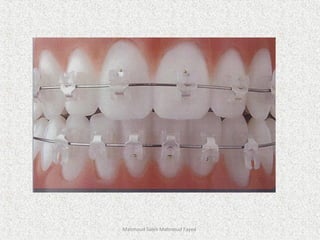 Mahmoud Saleh Mahmoud Fayed
 