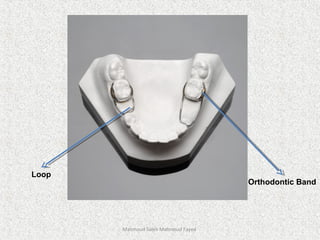Mahmoud Saleh Mahmoud Fayed
Orthodontic Band
Loop
 