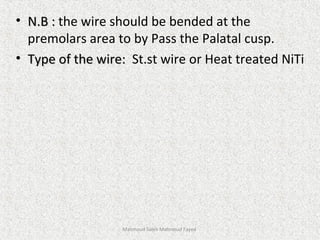 • N.B :N.B : the wire should be bended at the
premolars area to by Pass the Palatal cusp.
• Type of the wire:Type of the wire: St.st wire or Heat treated NiTi
Mahmoud Saleh Mahmoud Fayed
 