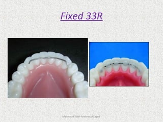 Mahmoud Saleh Mahmoud Fayed
Fixed 33R
 