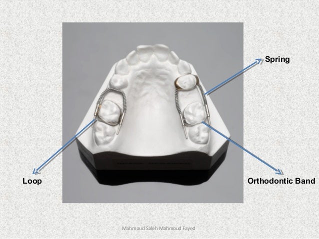 orthodontic appliances