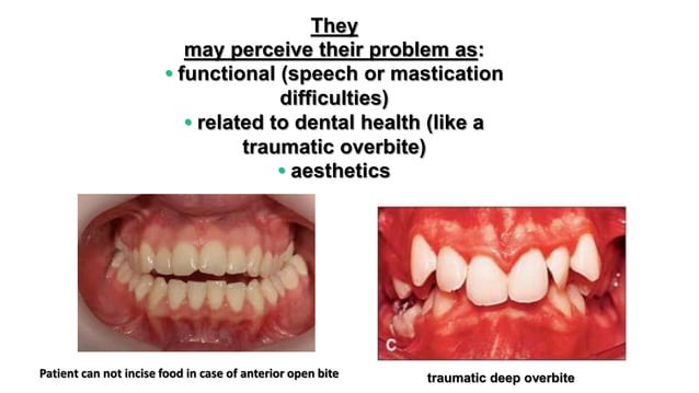 Orthodontic assessment of the patient | PPTX | Dental Health | Diseases ...
