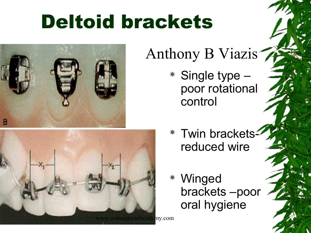 Orthodontic brackets part 1