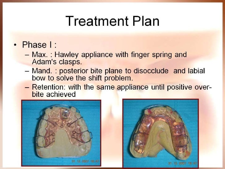 Orthodontic case presentation