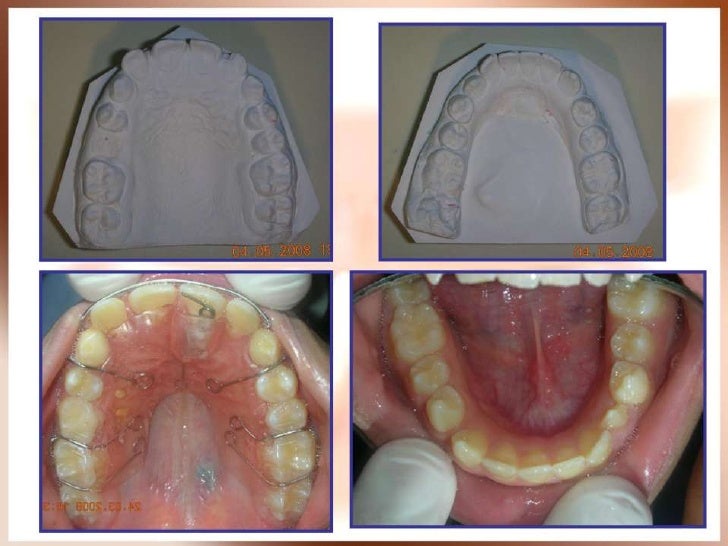 Orthodontic case presentation