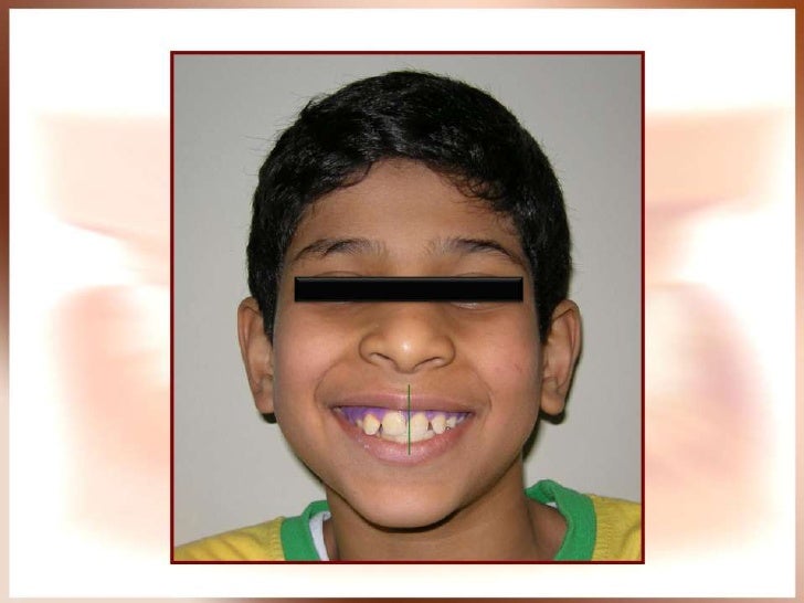 Orthodontic case presentation