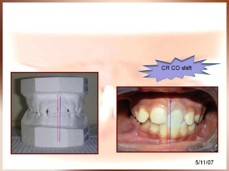 Orthodontic case presentation