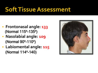 Orthodontic case presentation | PPTX