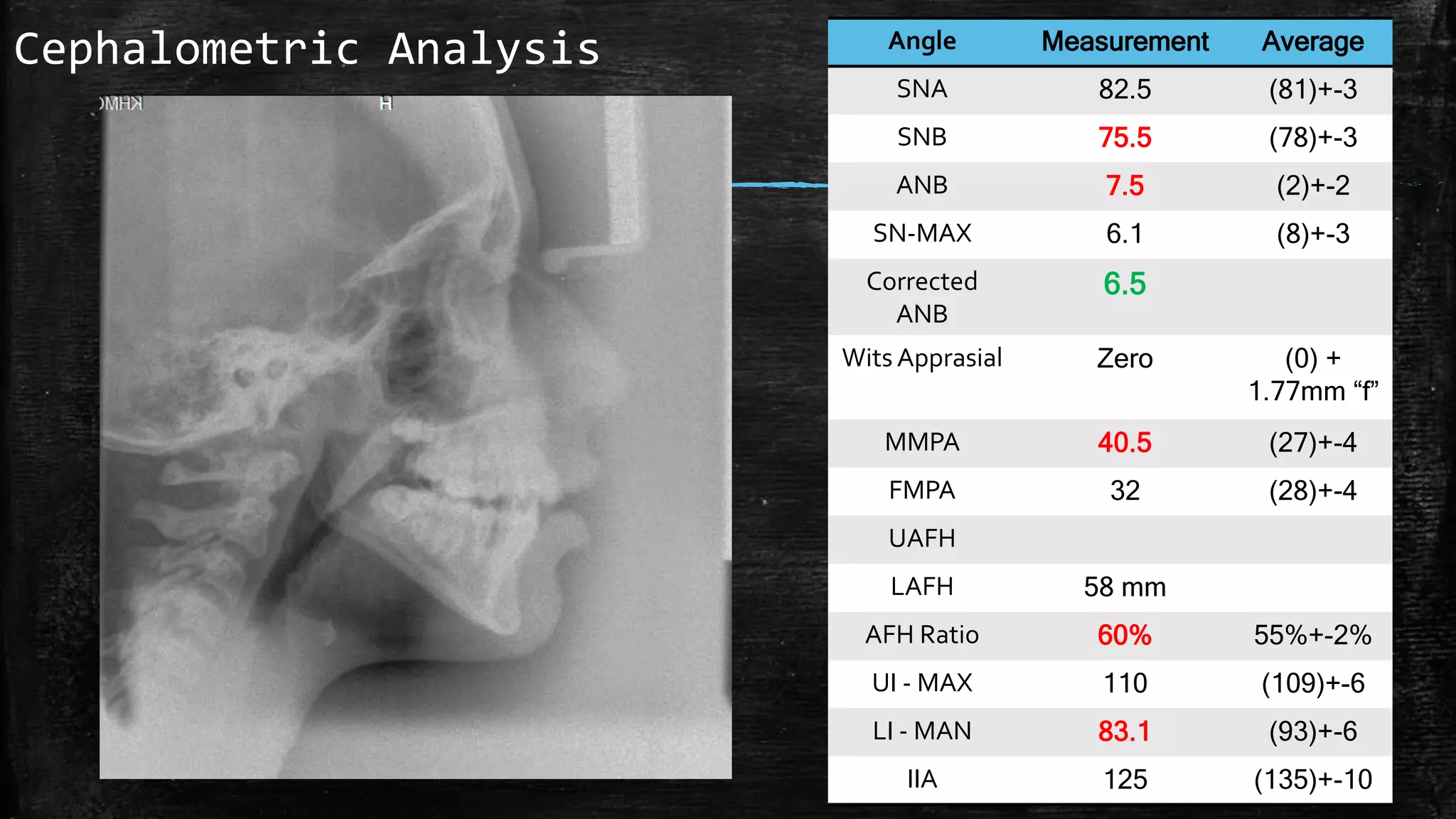 Orthodontic clinical case presentation - Dr shareef alshanableh | PPTX